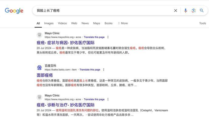 为啥百度搜索引擎打不开？常见原因有哪些？